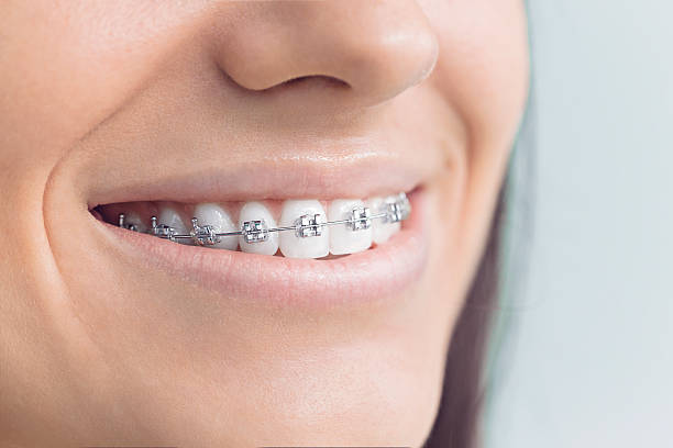 Best Teeth Whitening  in Riverdale, IL